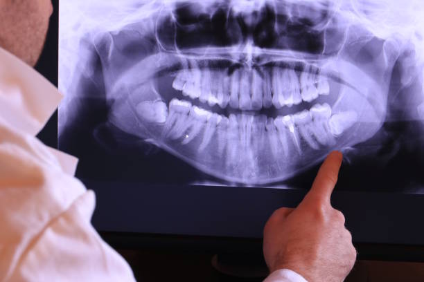 Best Emergency Tooth Extraction in Robinson, TX