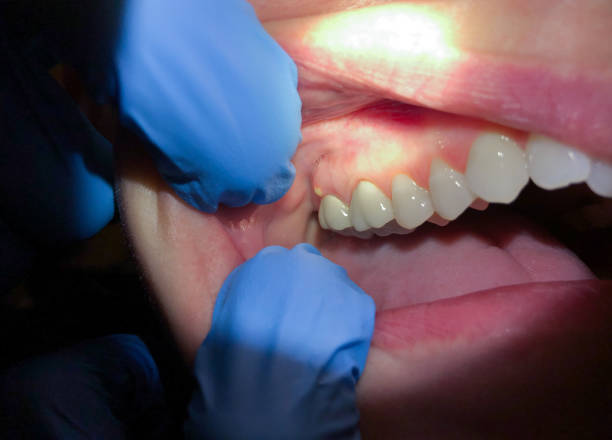 Best Walk-In Emergency Dentist in Robinson, TX