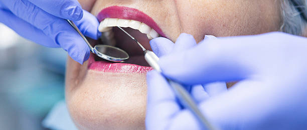 Best Emergency Wisdom Teeth Removal in Robinson, TX