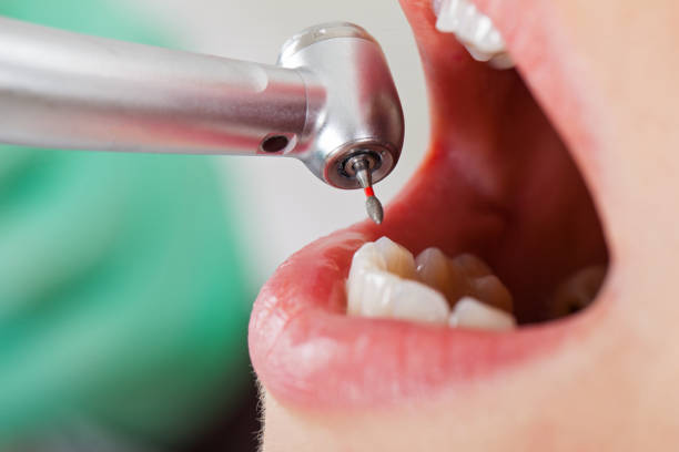 Best Emergency Treatment for Toothache in Robinson, TX